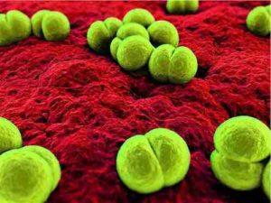 Названия болезней вызванных бактериями у людей