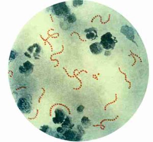 Названия болезней вызванных бактериями у людей